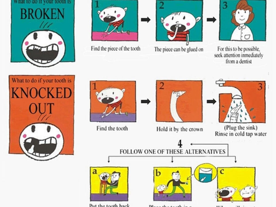 dental emergency broken tooth